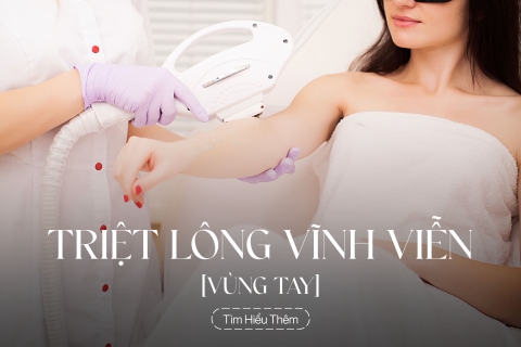 Triệt lông vùng tay vĩnh viễn